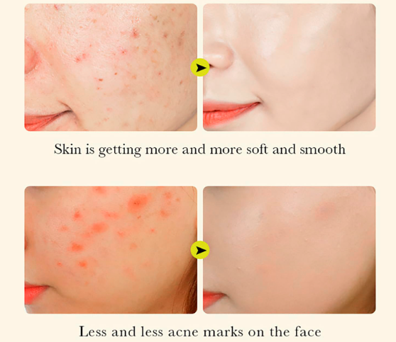 BIOAQUA Sérum Curcuma – Anti-Acné & Éclat | Sérum Apaisant Antioxydant au Curcuma Fermenté | Asli Shop Djibouti